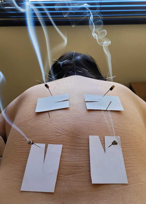 Mary – Medicina Oriental - Foto 2